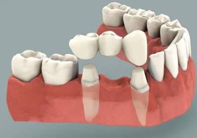 Periodontics